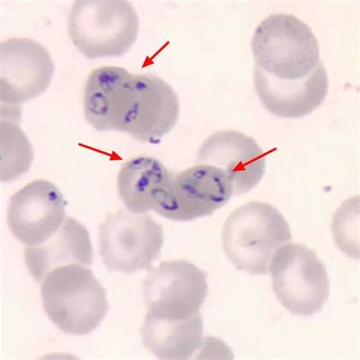  Babesia! Un Parasite Microscopique Qui Démontre Que La Taille N'Est Pas Toujours Synonyme de Puissance