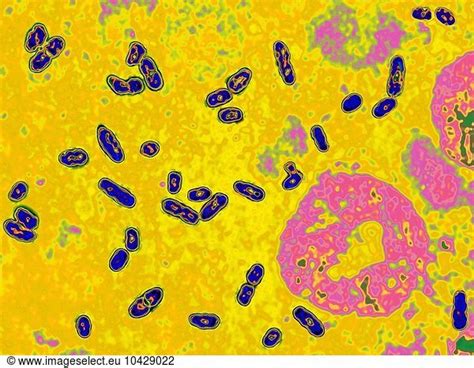  Yersinia Pestis: A Tiny Terror Hiding In Plain Sight – Unveiling the Secrets Of This Unassuming Microbial Menace!