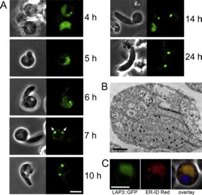  Ookinete: Un Parasite Microscopique aux Voyages Époustouflants! Ookinetes, ces minuscules parasites unicellulaires qui ressemblent à des torpilles vivantes, font partie du groupe des Sporozoaires et sont connus pour leur capacité à voyager à travers le système circulatoire de leurs hôtes avec une précision incroyable.