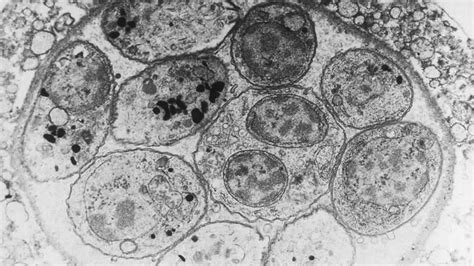  _Toxoplasma gondii_: Un parasite insidieux qui contrôle l'esprit de ses hôtes!