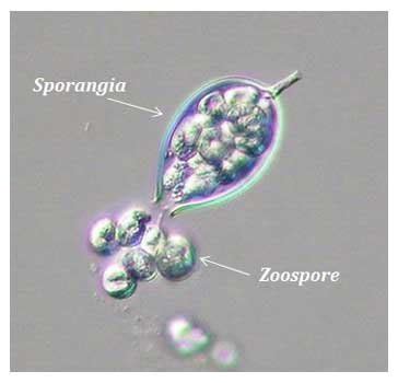  Zoosporangium! Une moisissure aquatique fascinante aux spores mobiles